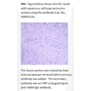ai80013a ihc large 2.png