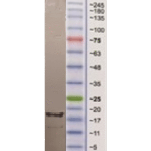 il 17a 6f2 100ng.png