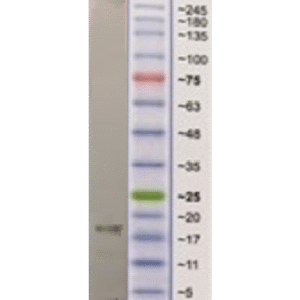 il 17a 7f10 100ng.png