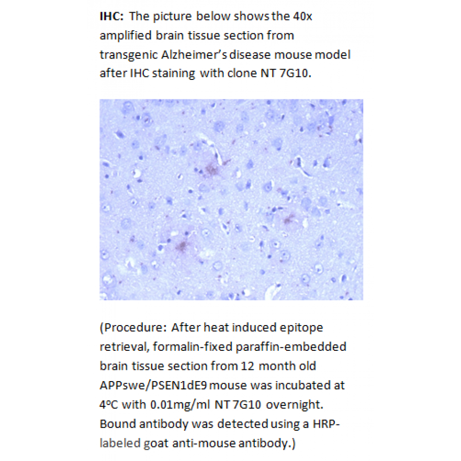 mo m40094i ihc large 3.png mo m40094i ihc large 3.png