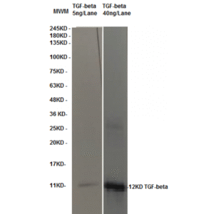 tgfbeta 2c6 wb.png